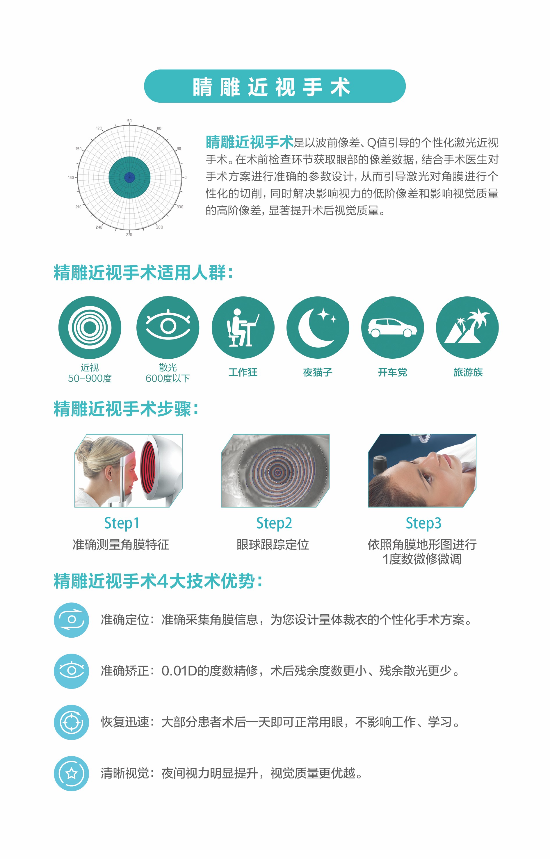精雕近視手術(shù) 精雕近視手術(shù)